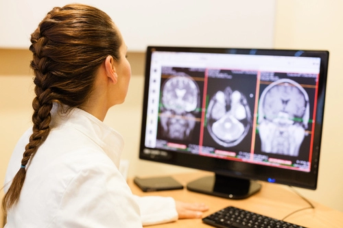 Undiagnosed Brain Injuries Common in Survivors
