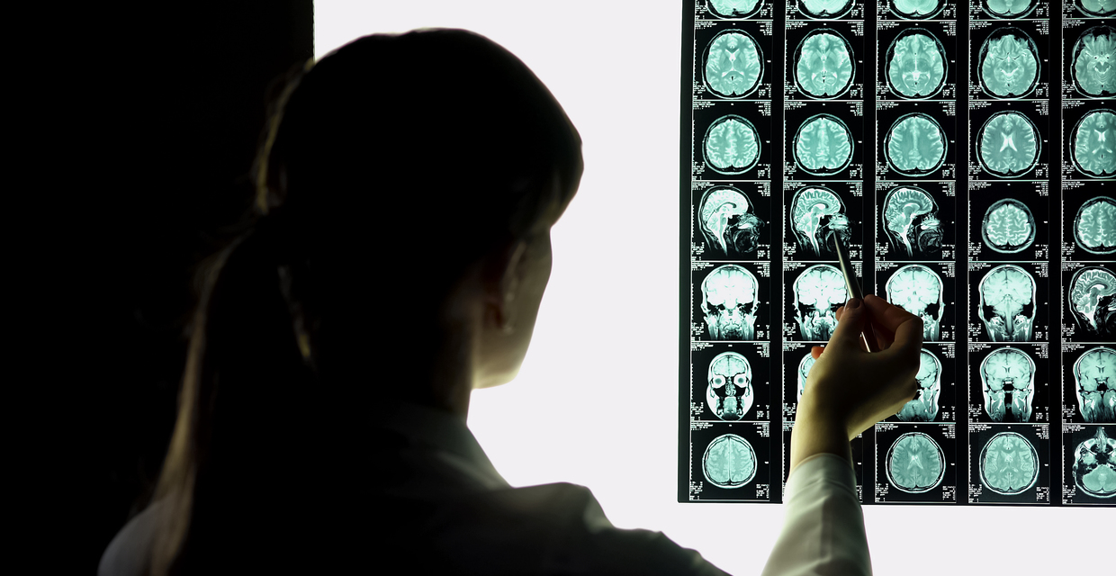 Finally, New Brain Injury Study Focuses on Survivors of DV