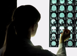 Finally, New Brain Injury Study Focuses on Survivors of DV